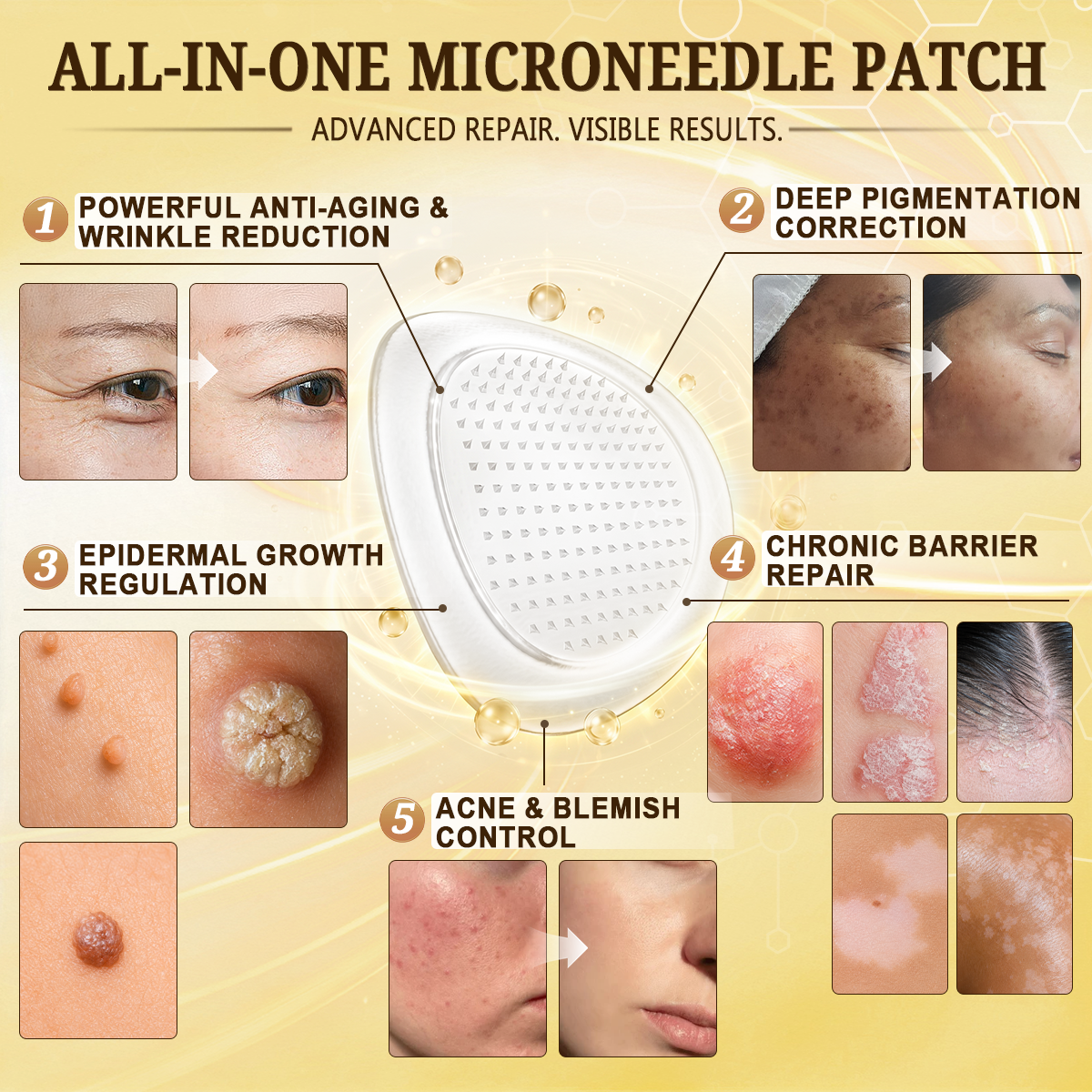 🎉 LUCKY YOU! Your Exclusive 80% OFF Skin Upgrade Is Ready! HISKIN® Repair Microneedle Patches | Just Apply & Go For Easy Skin Nourishment, Hydration & Smoother-Looking Skin + 180-Day Guarantee