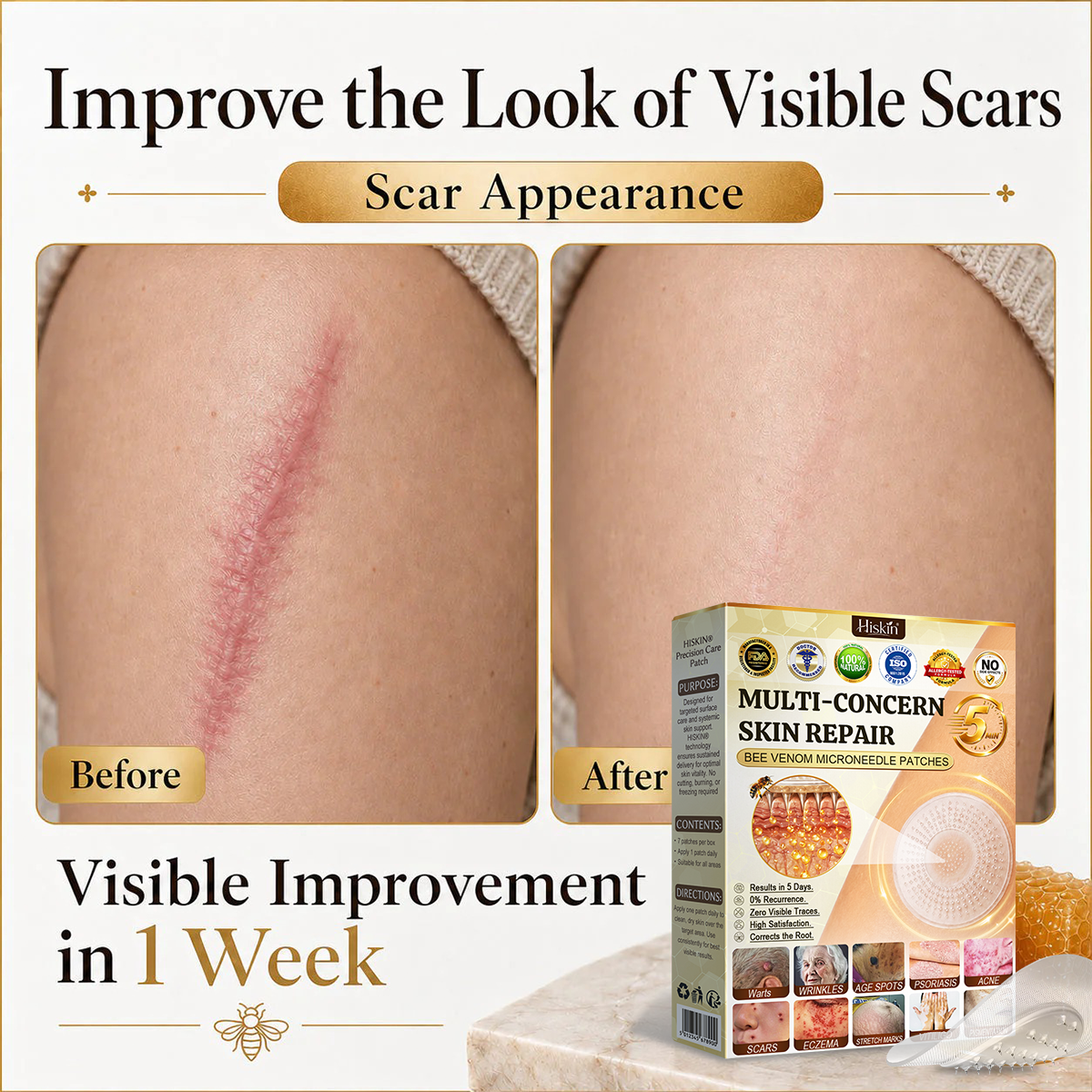 🎉 LUCKY YOU! Your Exclusive 80% OFF Skin Upgrade Is Ready! HISKIN® Repair Microneedle Patches | Just Apply & Go For Easy Skin Nourishment, Hydration & Smoother-Looking Skin + 180-Day Guarantee