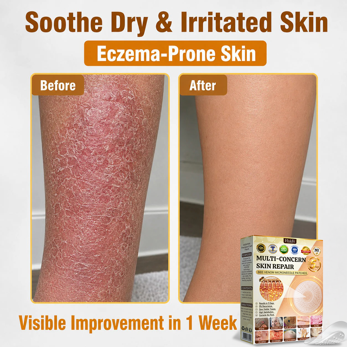 🎉 LUCKY YOU! Your Exclusive 80% OFF Skin Upgrade Is Ready! HISKIN® Repair Microneedle Patches | Just Apply & Go For Easy Skin Nourishment, Hydration & Smoother-Looking Skin + 180-Day Guarantee