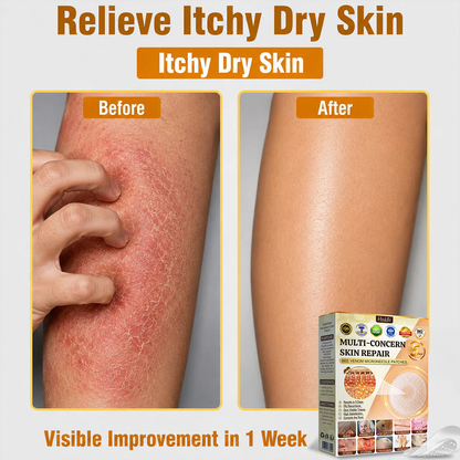 🎉 LUCKY YOU! Your Exclusive 80% OFF Skin Upgrade Is Ready! HISKIN® Repair Microneedle Patches | Just Apply & Go For Easy Skin Nourishment, Hydration & Smoother-Looking Skin + 180-Day Guarantee
