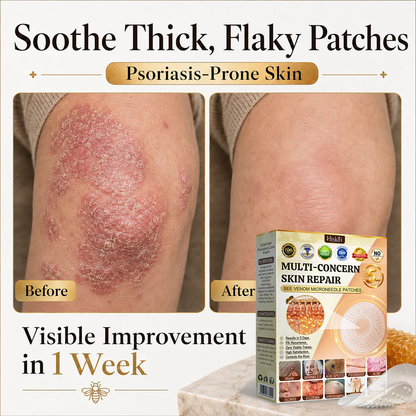 🎉 LUCKY YOU! Your Exclusive 80% OFF Skin Upgrade Is Ready! HISKIN® Repair Microneedle Patches | Just Apply & Go For Easy Skin Nourishment, Hydration & Smoother-Looking Skin + 180-Day Guarantee