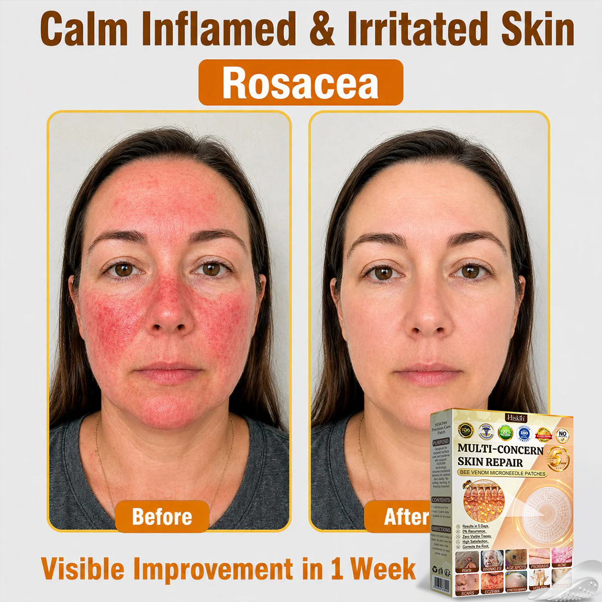 🎉 LUCKY YOU! Your Exclusive 80% OFF Skin Upgrade Is Ready! HISKIN® Repair Microneedle Patches | Just Apply & Go For Easy Skin Nourishment, Hydration & Smoother-Looking Skin + 180-Day Guarantee
