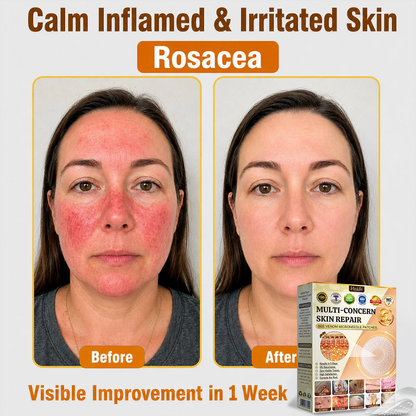 🎉 LUCKY YOU! Your Exclusive 80% OFF Skin Upgrade Is Ready! HISKIN® Repair Microneedle Patches | Just Apply & Go For Easy Skin Nourishment, Hydration & Smoother-Looking Skin + 180-Day Guarantee