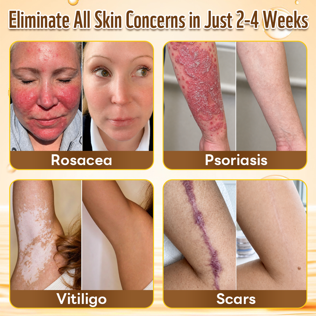 🎁 DON’T LEAVE THIS VIP DEAL BEHIND 80% OFF HISKIN® Skin Repair Cream | Smooth The Look Of Wrinkles, Hydrate & Restore A Youthful Glow + 180-Day Guarantee