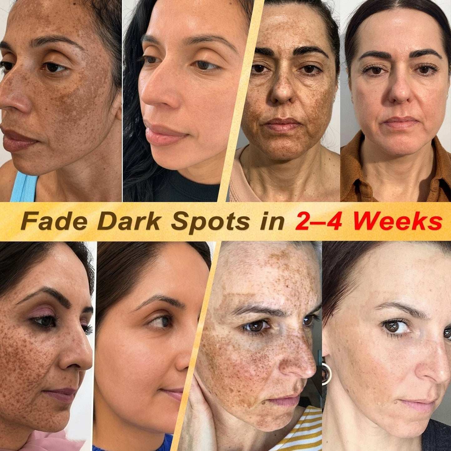 🎁 DON’T LEAVE THIS VIP DEAL BEHIND 80% OFF HISKIN® Skin Repair Cream | Smooth The Look Of Wrinkles, Hydrate & Restore A Youthful Glow + 180-Day Guarantee