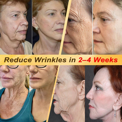 🎁 DON’T LEAVE THIS VIP DEAL BEHIND 80% OFF HISKIN® Skin Repair Cream | Smooth The Look Of Wrinkles, Hydrate & Restore A Youthful Glow + 180-Day Guarantee