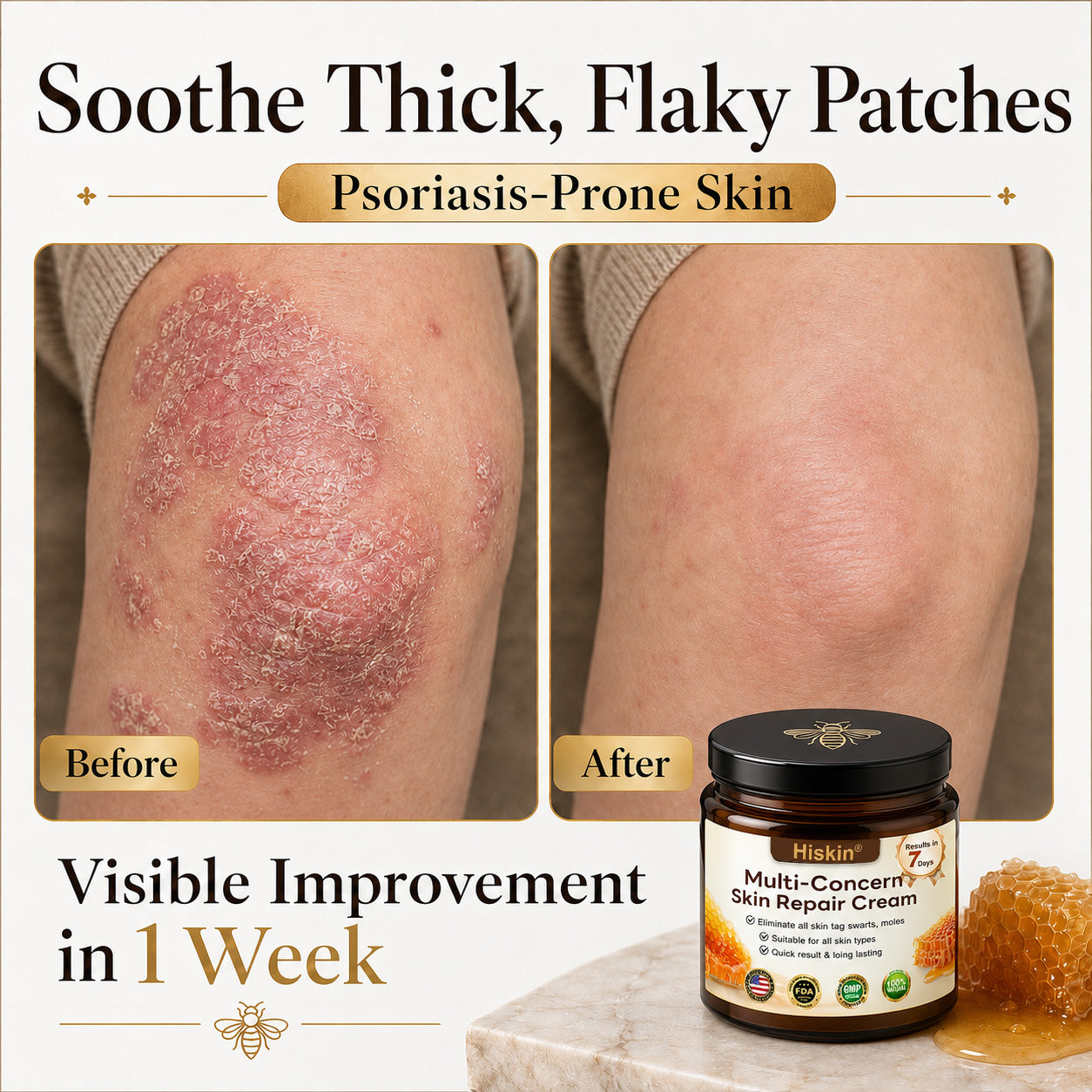 ✨🐝𝐇𝐈𝐒𝐊𝐈𝐍® 𝐌𝐮𝐥𝐭𝐢-𝐂𝐨𝐧𝐜𝐞𝐫𝐧 𝐒𝐤𝐢𝐧 𝐑𝐞𝐩𝐚𝐢𝐫 𝐂𝐫𝐞𝐚𝐦 (𝐎𝐧𝐞 𝐩𝐨𝐰𝐞𝐫𝐟𝐮𝐥 𝐜𝐫𝐞𝐚𝐦 𝐭𝐨 𝐫𝐞𝐩𝐚𝐢𝐫 𝐢𝐧𝐟𝐥𝐚𝐦𝐦𝐚𝐭𝐢𝐨𝐧, 𝐝𝐫𝐲𝐧𝐞𝐬𝐬, 𝐚𝐠𝐢𝐧𝐠, 𝐩𝐢𝐠𝐦𝐞𝐧𝐭𝐚𝐭𝐢𝐨𝐧, 𝐚𝐧𝐝 𝐯𝐢𝐬𝐢𝐛𝐥𝐞 𝐬𝐤𝐢𝐧 𝐝𝐚𝐦𝐚𝐠𝐞.)
