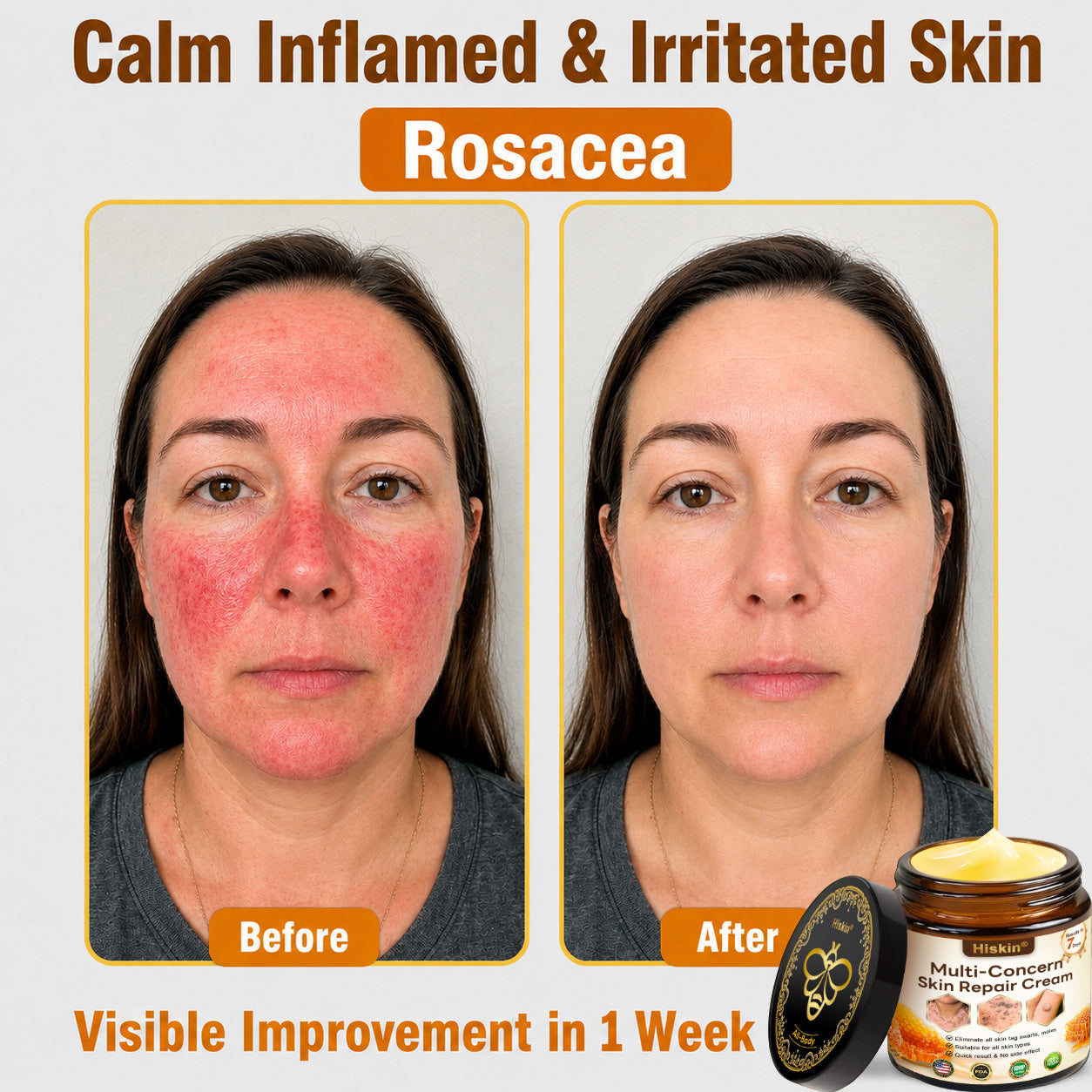 🎁 DON’T LEAVE THIS VIP DEAL BEHIND 80% OFF HISKIN® Skin Repair Cream | Smooth The Look Of Wrinkles, Hydrate & Restore A Youthful Glow + 180-Day Guarantee