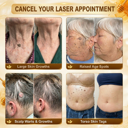🎁 DON’T LEAVE THIS VIP DEAL BEHIND 80% OFF HISKIN® Skin Repair Cream | Smooth The Look Of Wrinkles, Hydrate & Restore A Youthful Glow + 180-Day Guarantee
